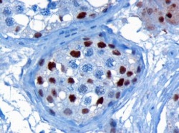 KPNA4 Antibody