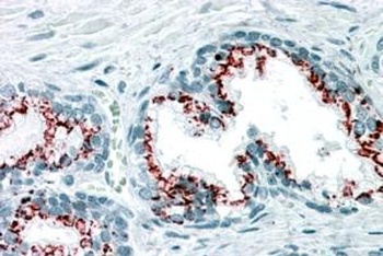 GOLPH2 Antibody