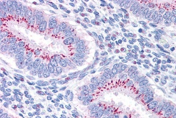 GOLPH2 Antibody