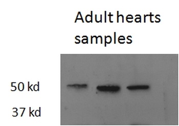 GLuR5 Antibody