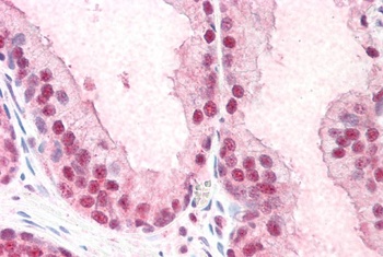 FIR Antibody