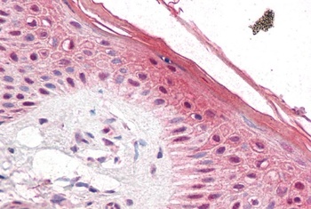 FIR Antibody