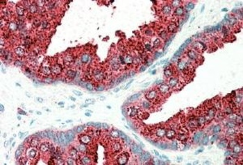 ELMO3 Antibody
