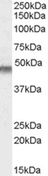 CRP2 Antibody