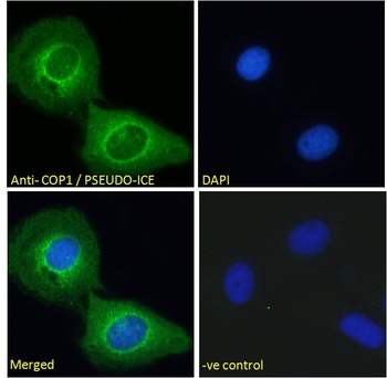 COP1 Antibody