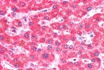 CMG1 Antibody