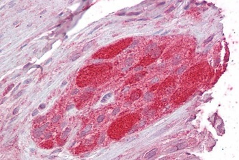 CHIP Antibody