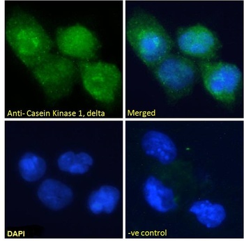 Casein Kinase 1 Antibody