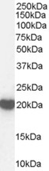 Casein Kinase 1 Antibody