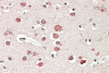 Biglycan Preproprotein Antibody