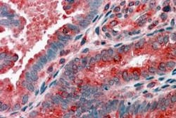 ARP1 Antibody