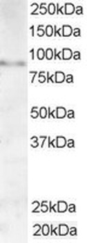 AKAP3 Antibody