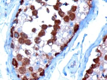 TCP-1 Antibody