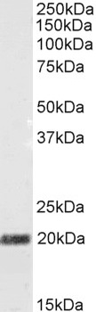 STMN2 Antibody