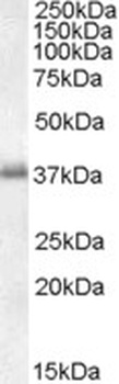 LAT Antibody
