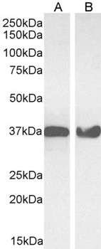 GAPDH Antibody