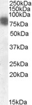 Cortactin Antibody