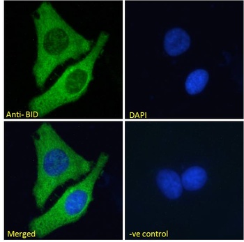 BID Antibody