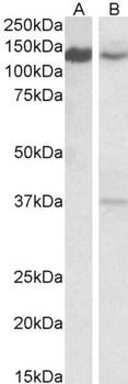 TICAM-1 / TRIF Antibody