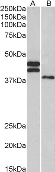 CTNNB1 / catenin beta-1 Antibody