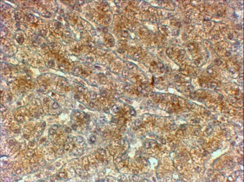 CTNNB1 / catenin beta-1 Antibody
