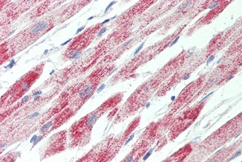 tropomyosin 4 / TPM4 Antibody