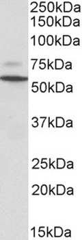 tropomyosin 4 / TPM4 Antibody