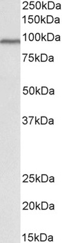 tropomyosin 4 / TPM4 Antibody