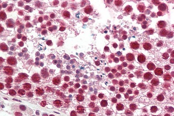 MARCH7 / Axotrophin Antibody