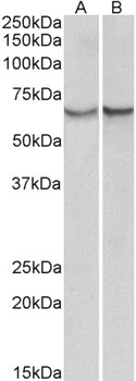 CLIC1 / NCC27 Antibody