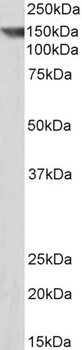 FBXO4 Antibody