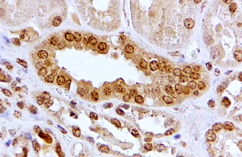 SERCA2 / ATP2A2 Antibody
