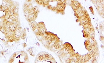 SERCA2 / ATP2A2 Antibody