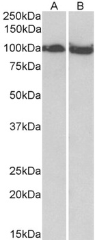 p15INK4b isoform 2 Antibody