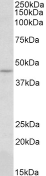 HIC1 Antibody