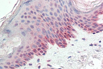 HIC1 Antibody