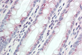 MDH1 / MOR2 Antibody