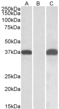 PRKCB Antibody