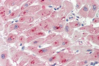 PRKCB Antibody