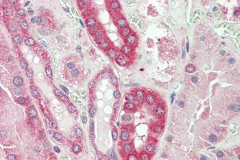 MDH1 / MOR2 Antibody