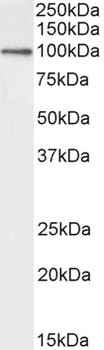 calbindin D28 Antibody