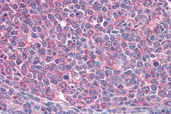 MAP3K6 Antibody