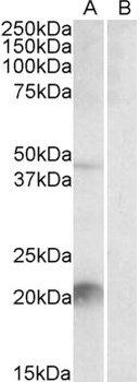 Afamin / alpha Albumin Antibody
