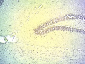 PGC1A Antibody