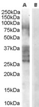 Makorin Antibody