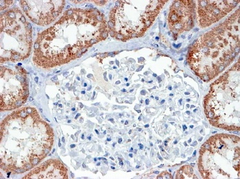USP16 / UBP-M Antibody