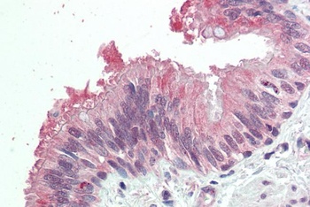 IKZF1 Antibody