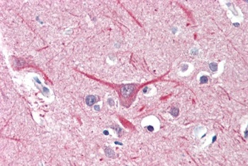 IKZF1 Antibody