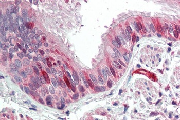 ACO1 Antibody