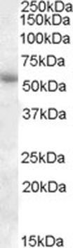IKZF1 Antibody